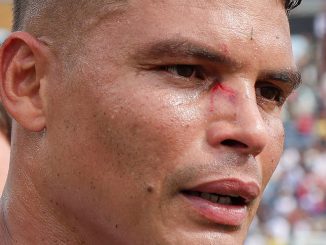 Thiago Silva ficou com um ferimento no rosto após a vitória sobre o Chelsea