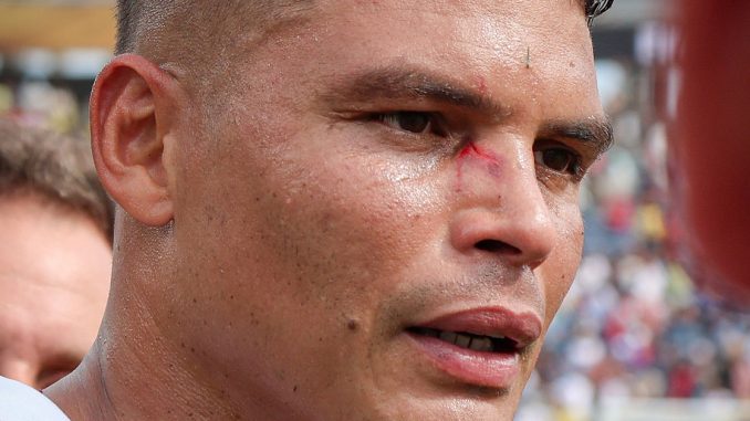 Thiago Silva ficou com um ferimento no rosto após a vitória sobre o Chelsea