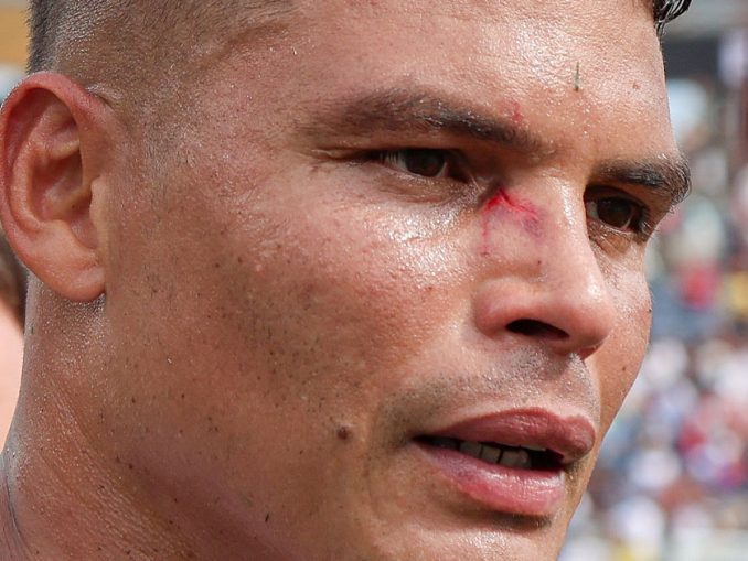 Thiago Silva ficou com um ferimento no rosto após a vitória sobre o Chelsea