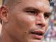 Thiago Silva ficou com um ferimento no rosto após a vitória sobre o Chelsea