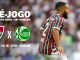 Fluminense x Juventude - Brasileirão 2025