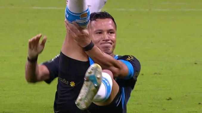 Ex-Fluminense, Marlon fraturou a perna em Grêmio x Vitória